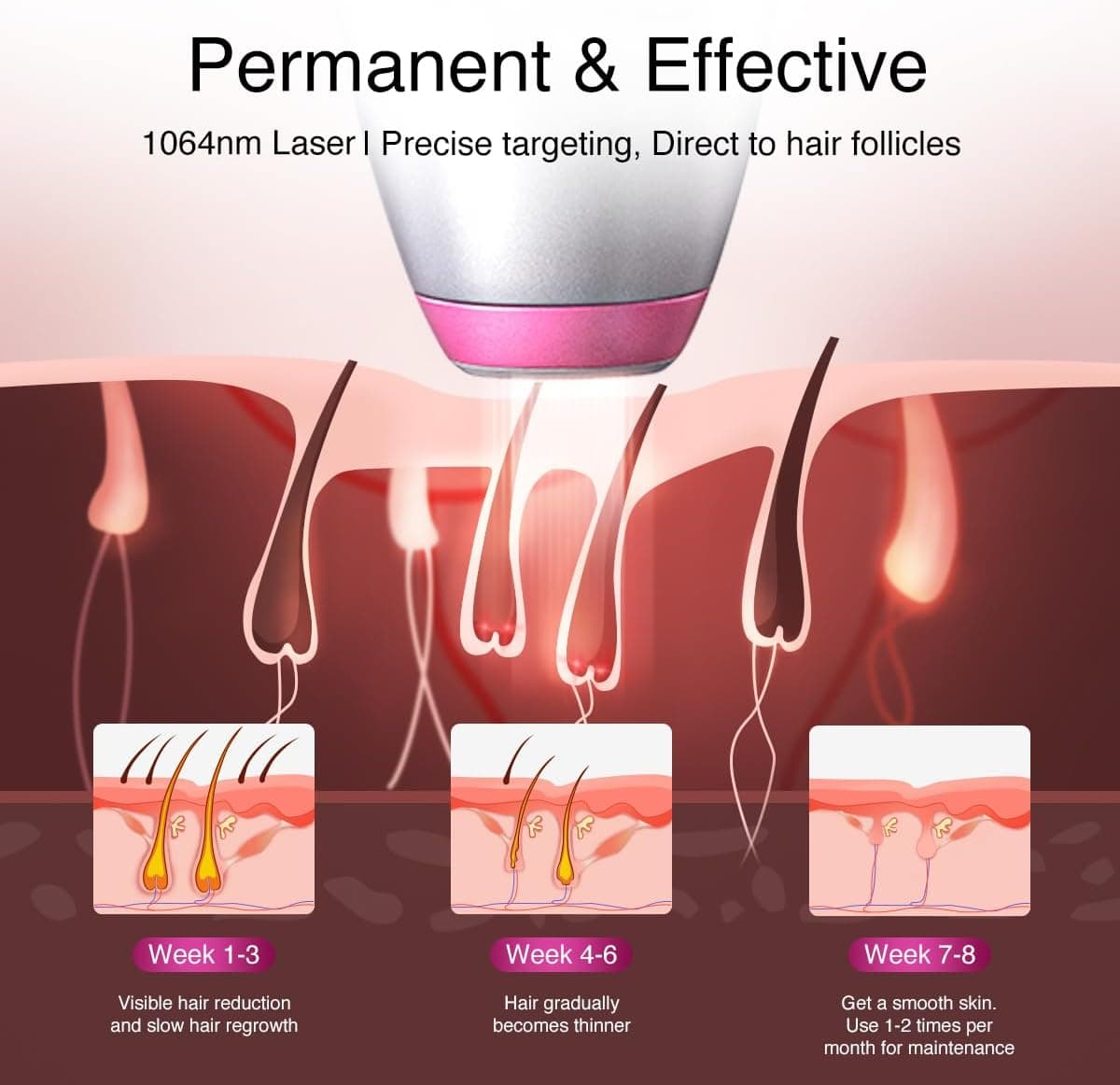 DermRays 1064 nm Diodenlaser-Haarentfernung für Frauen und Männer, für Hauttöne 1-6, Eiskühlung, großflächige Haarentfernung für Gesicht, Körper, für tiefe Haut